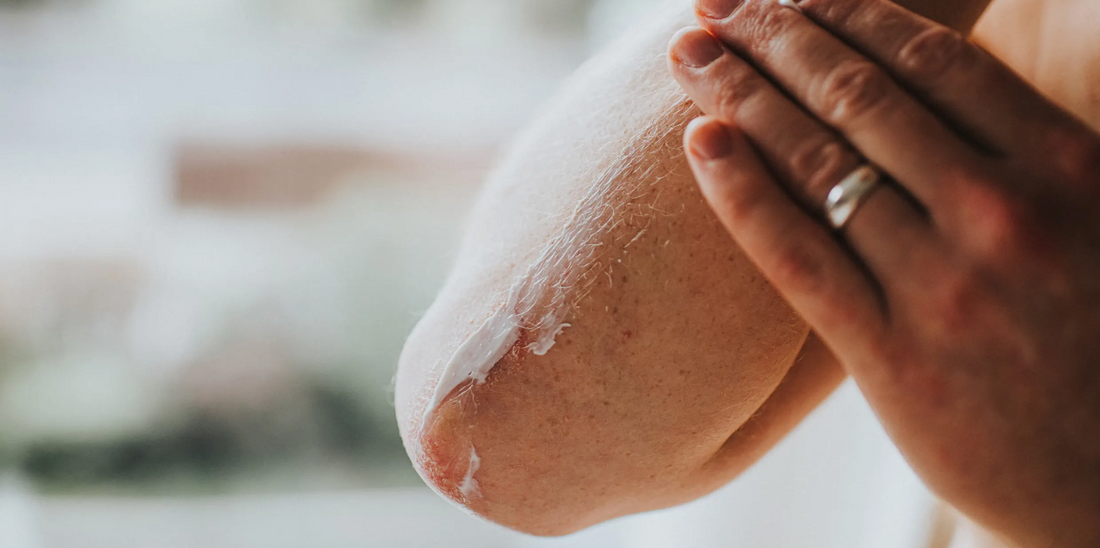 Kamedis' Eczema Therapy Cream: A Top Pick for Eczema Relief on Today.com