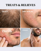 Dandruff Free Beard Wash | CONTROL