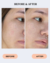 Load image into Gallery viewer, Facial Redness &amp; Flaking Relief Cream | SEBO CONTROL
