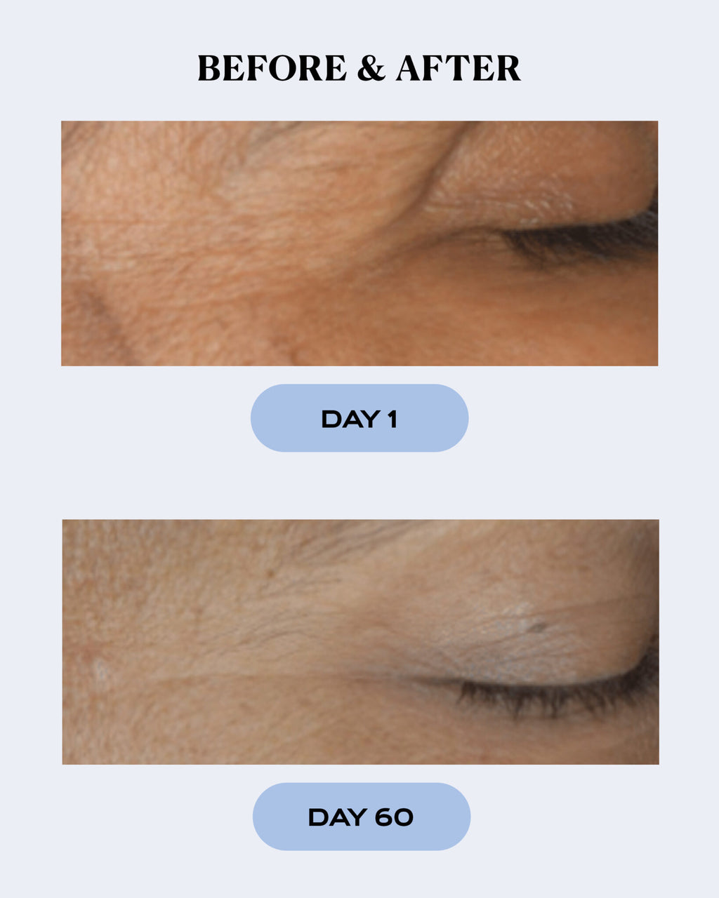 Hydrating Skin Recovery Gel | CALM
