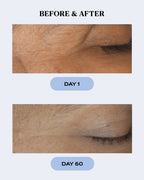 Hydrating Skin Recovery Gel | CALM