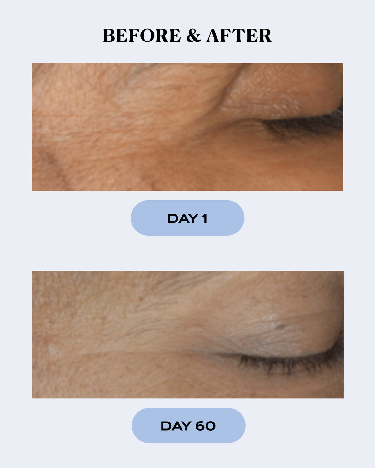 Hydrating Skin Recovery Gel | CALM