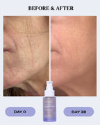 Hydrating & Soothing Serum for Sensitive Skin | BIO BALANCE