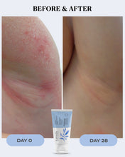 Load image into Gallery viewer, Eczema &amp; Itch Relief Cream | CALM
