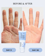 Intensive Hand Relief Cream | CALM