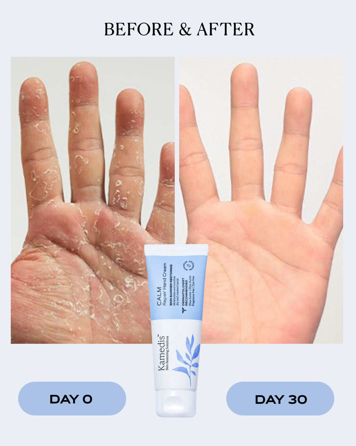Intensive Hand Relief Cream | CALM