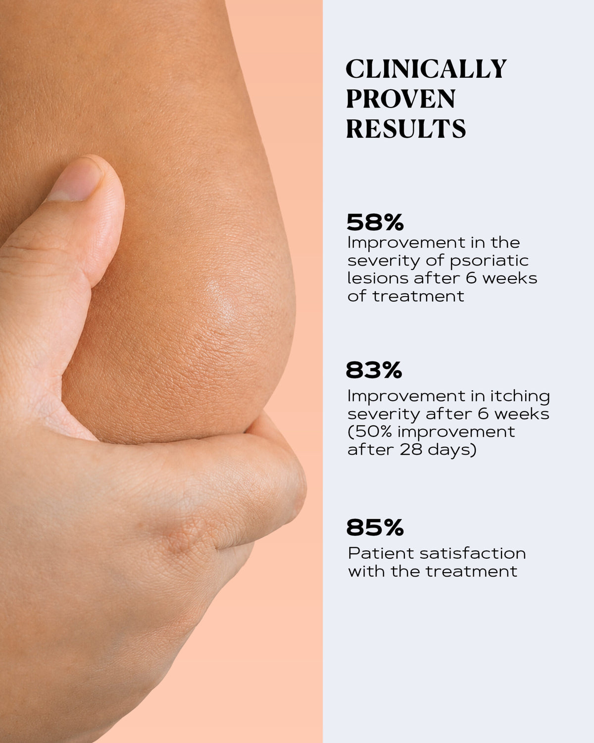 Rich Body Cream for Dry and Scaly Skin | PSO CONTROL
