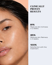 Load image into Gallery viewer, Facial Redness &amp; Flaking Relief Cream | SEBO CONTROL
