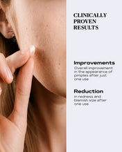 Load image into Gallery viewer, Advanced Transparent Pimple Patches for Fast Blemish Relief | CLEAR
