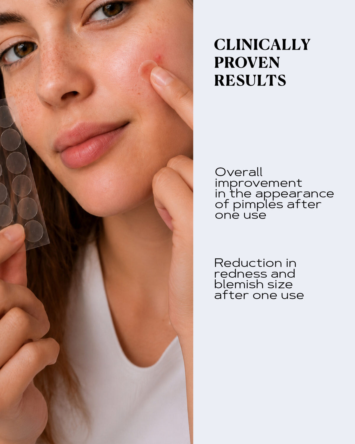 Advanced Transparent Pimple Patches for Fast Blemish Relief | CLEAR