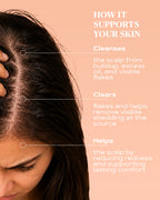 Anti-Dandruff Shampoo | SCALP CONTROL