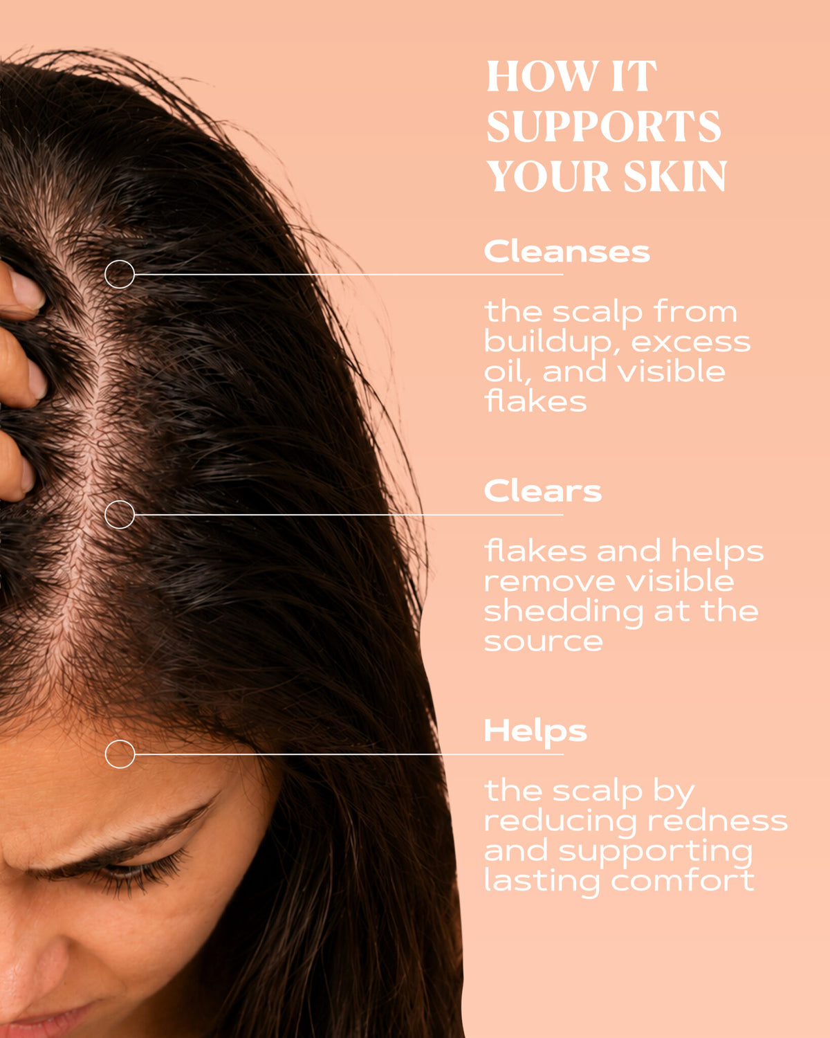 Anti-Dandruff Shampoo | SCALP CONTROL