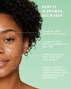 Pimple Relief Spot Treatment | CLEAR