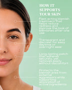 Advanced Transparent Pimple Patches for Fast Blemish Relief | CLEAR