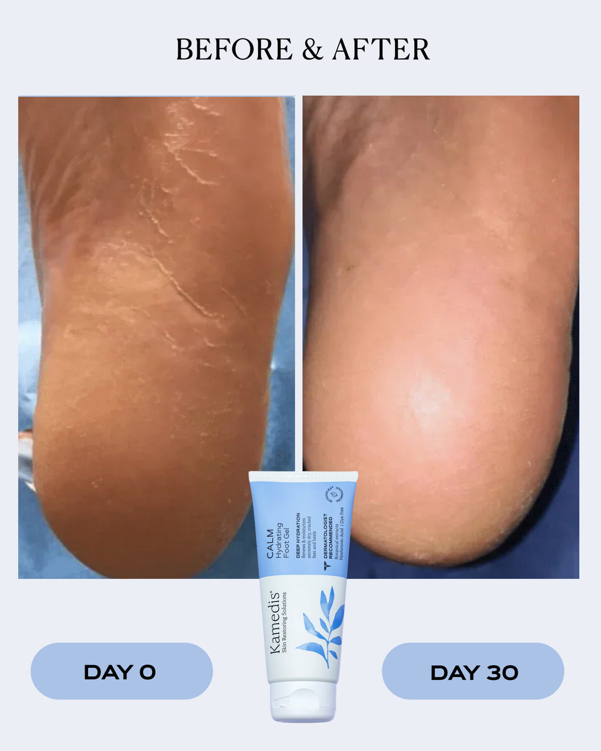 Intensive Hydrating Foot Gel | CALM