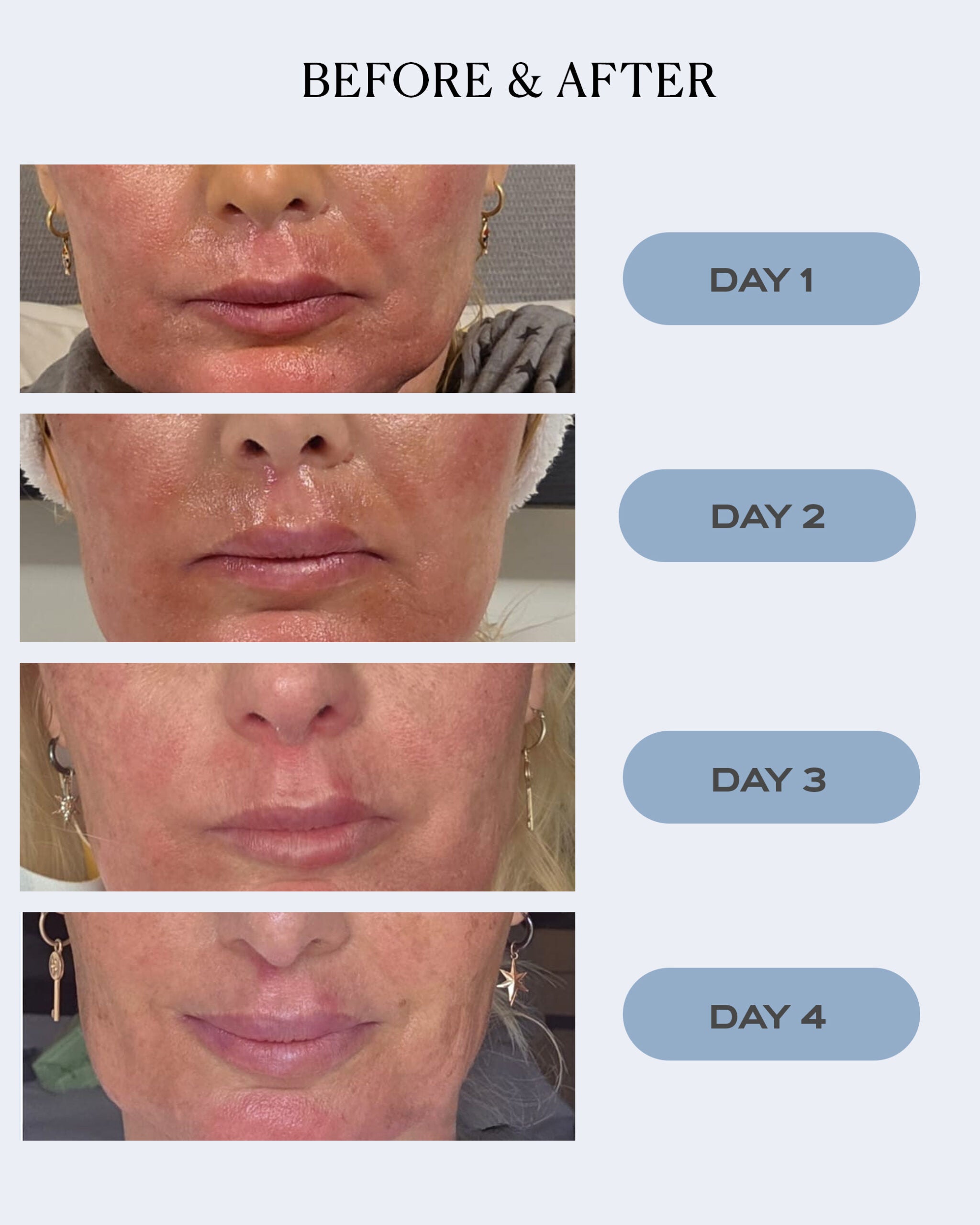 Instant Relief Gel